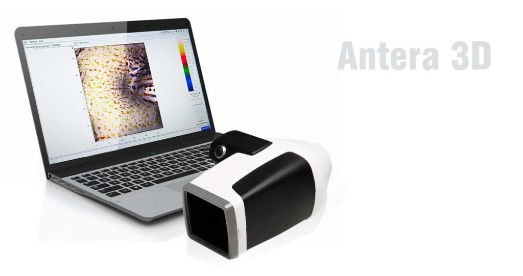 Antera 3D - диагностика кожи в Клинике Premium Aesthetics