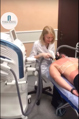 Лечение рубцов постакне в клинике Premium Aesthetics - смотрите видео, Академия косметологии Premium Aesthetics на Курской